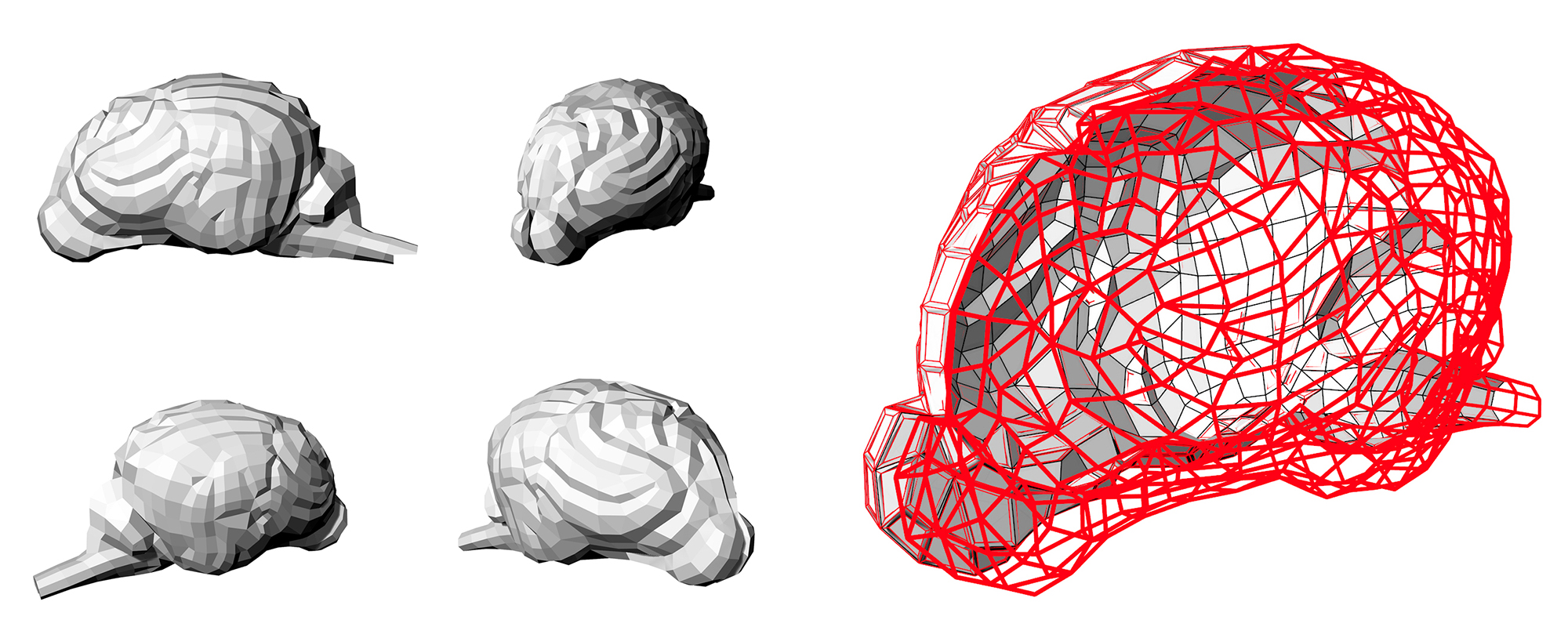 brain overlay render